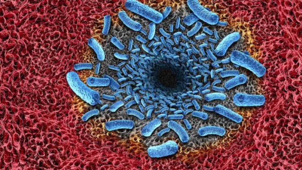 Flesh-Eating Bacteria Death Toll Hits Double Digits Across US as Cases Rise in Gulf States