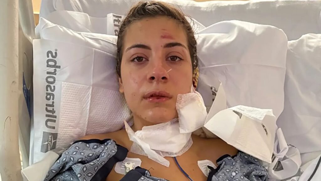 New York Woman Suffers Life-Threatening Injuries After Coworker Allegedly Attacks Her With Knife